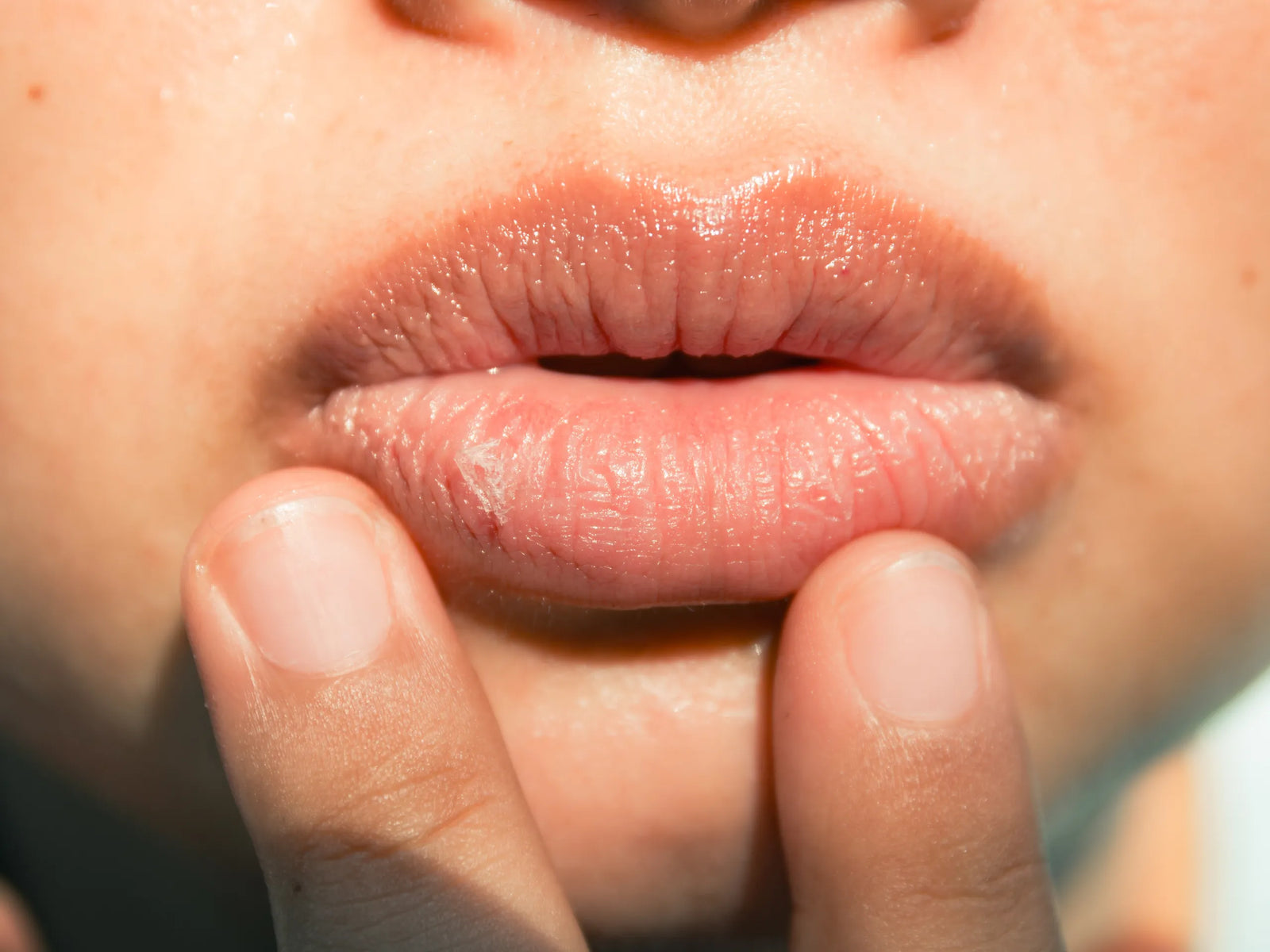 What Is Lip Skin Barrier Repair — And Why It Matters